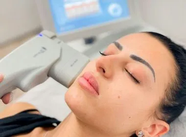 Hifu Facial: Belleza y Valor en Cada Detalle